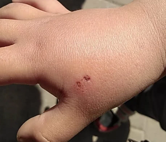 銀狐鼠咬人原因 銀狐鼠咬人原因