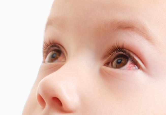 眼睛異物感處理