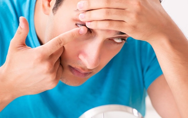 眼睛紅癢怎麼辦